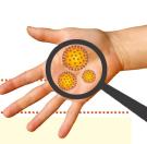 Jak se chránit proti hepatitidě A? Doporučení k preventivním opatřením.